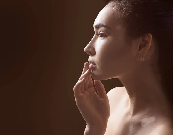 Portret van een mooie vrouw met vitiligo. — Stockfoto