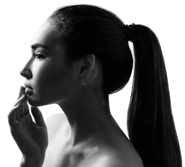 Porträt der schönen Frau mit Vitiligo. — Stockfoto