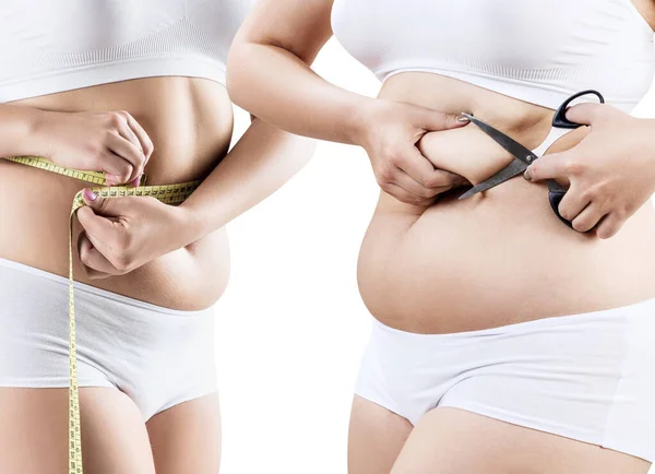 Collage di donna grassa con pieghe addominali . — Foto Stock