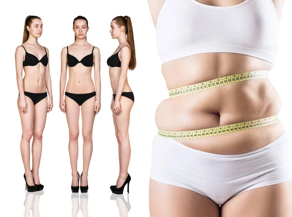 Kvinnans kropp före och efter viktminskning. — Stockfoto