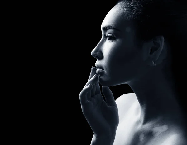 Retrato de mulher bonita com vitiligo . — Fotografia de Stock