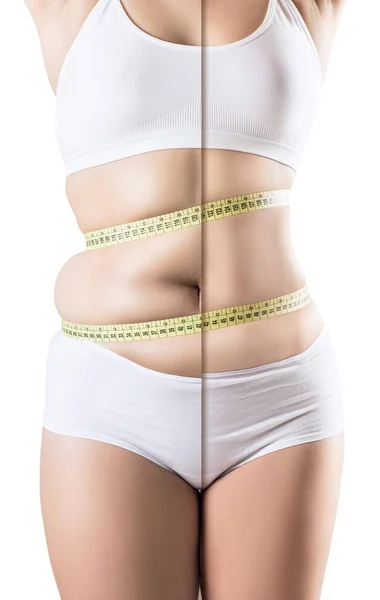 Kvinnans kropp före och efter viktminskning. — Stockfoto