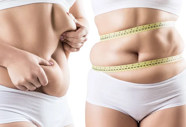 Collage de mujer gorda con pliegues abdominales . — Foto de Stock