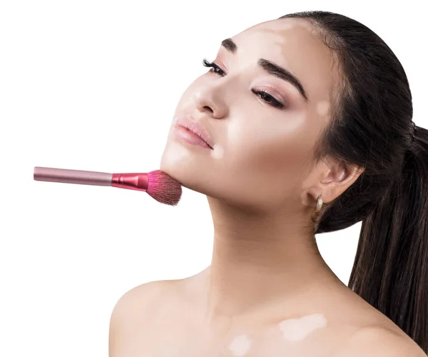 Mooie vrouw met vitiligo ziekte met make-up borstel. — Stockfoto