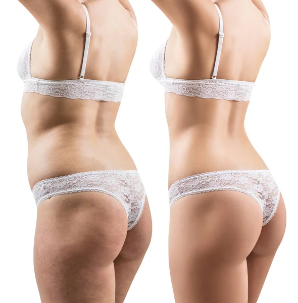 Colagem do corpo feminino antes e depois da perda de peso . — Fotografia de Stock