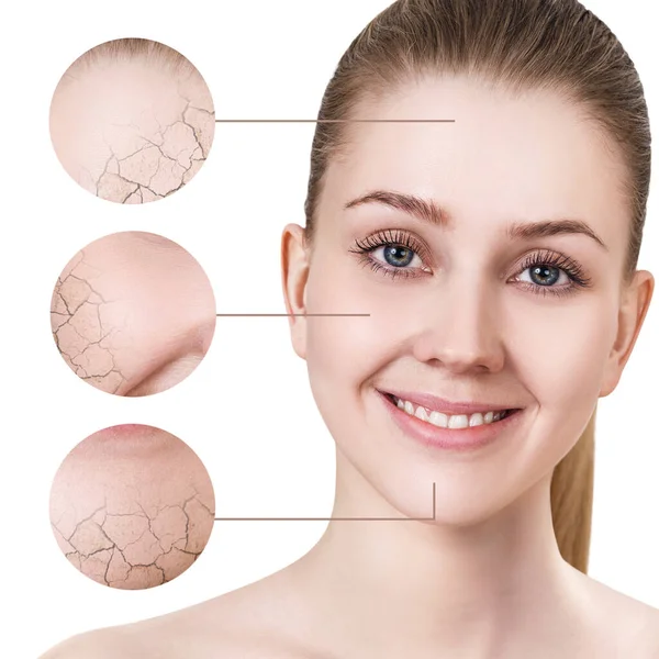 Zoom circle shows facial skin before moistening. — Stock Photo, Image