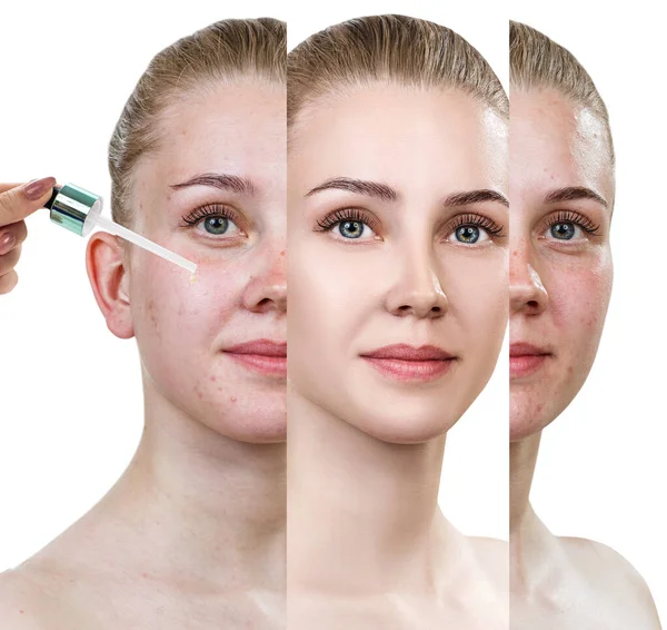 Óleo de cosméticos que se aplica na cara de mulher jovem . — Fotografia de Stock