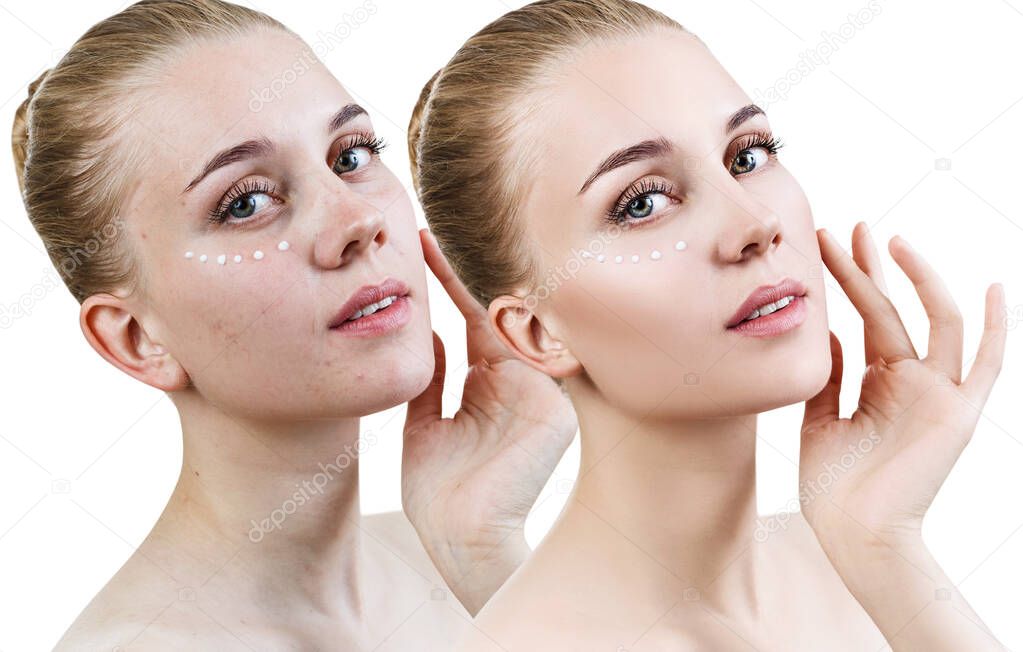 Young woman before and after retouch.