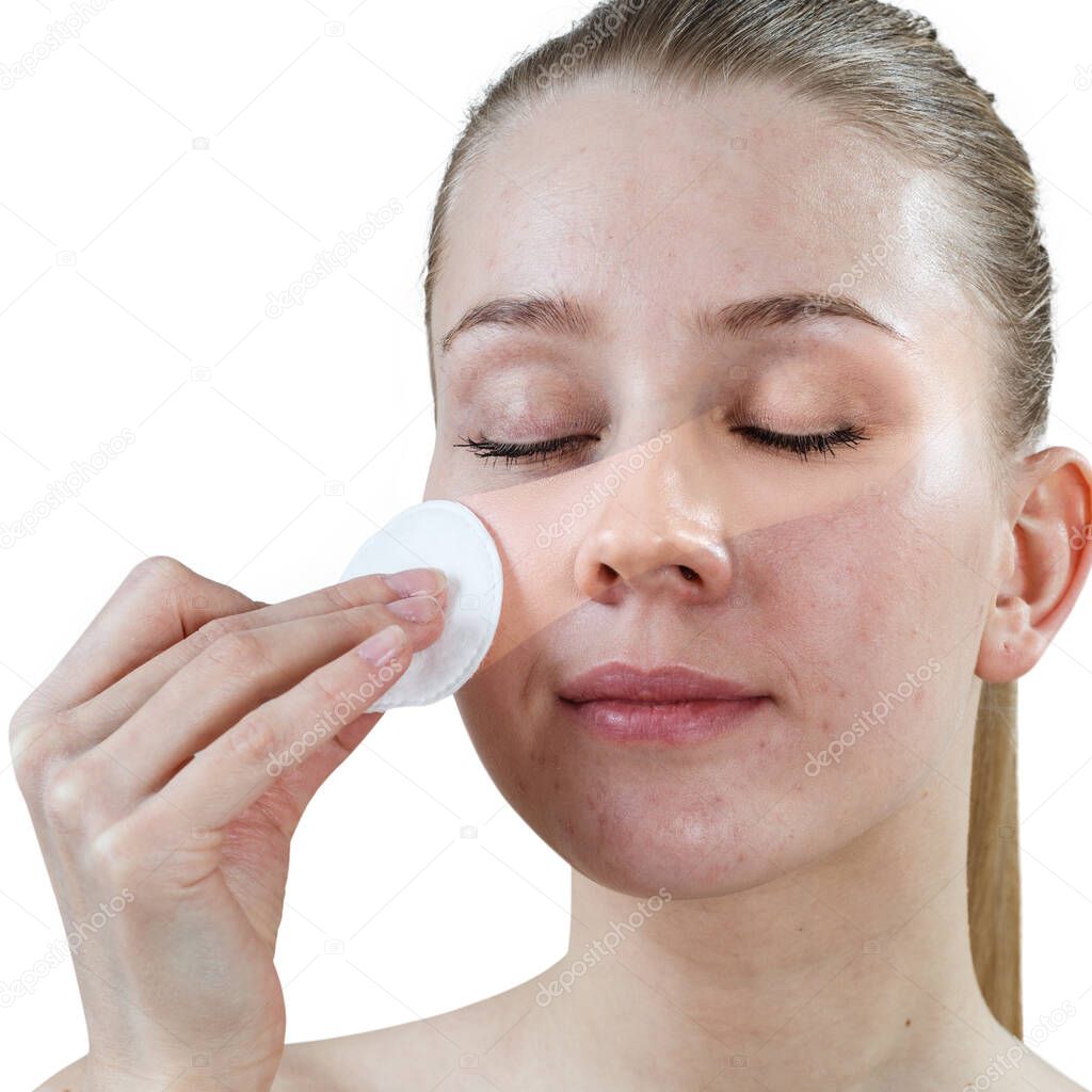 Woman cleaning her face by cotton disk. Skincare concept.