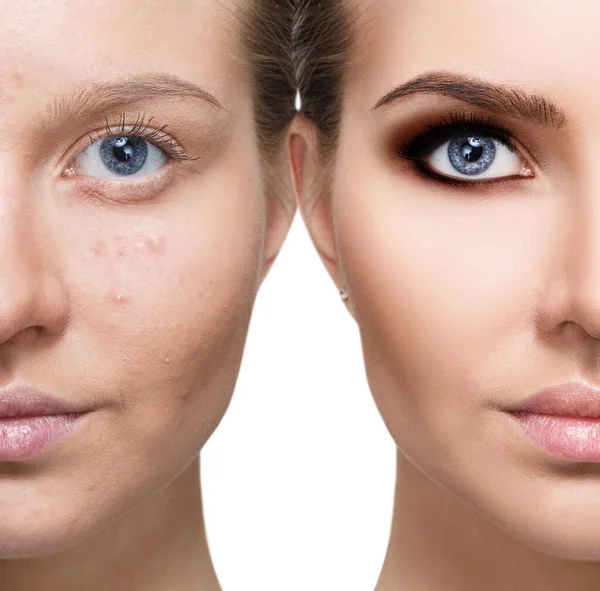 Young woman before and after treatment and bright makeup. — Stock Photo, Image