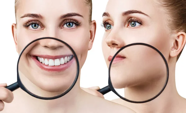 Collage di donna con lente d'ingrandimento mostra denti e pelle . — Foto Stock