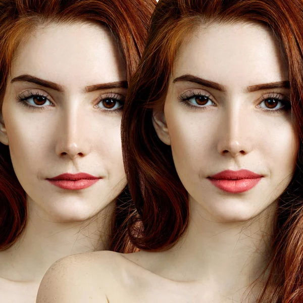 Lábios de mulher ruiva jovem antes e depois do aumento . — Fotografia de Stock