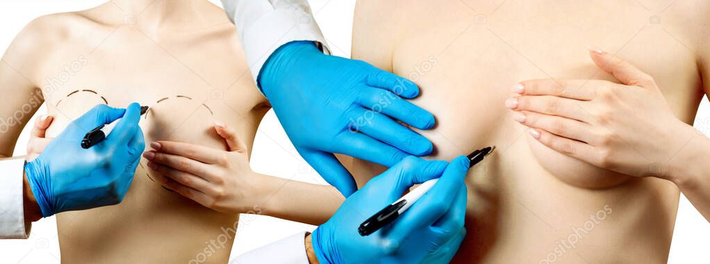 Doctor hand painting dotted line on female breast.