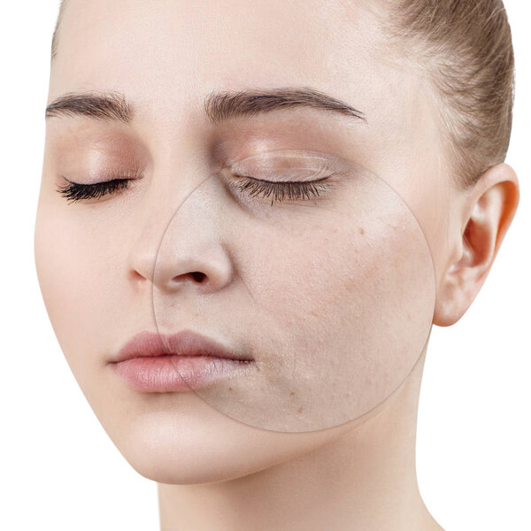 Circle on young woman shows before and after treatment and makeup.