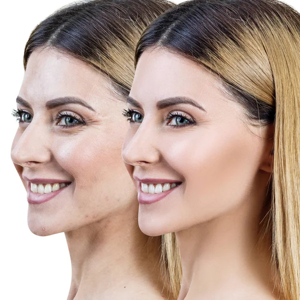 Adult happy woman before and after skin retouch or treatment. — Stock Photo, Image