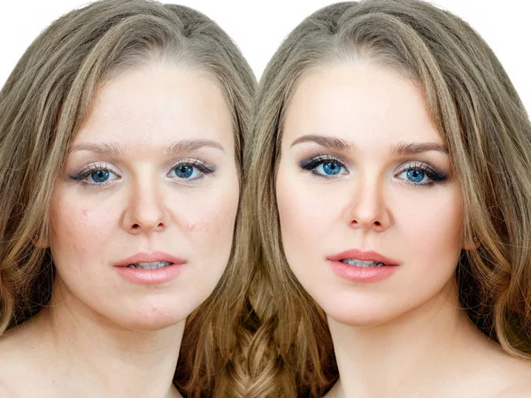 Жінка з прищами до і після лікування і макіяжу . — стокове фото