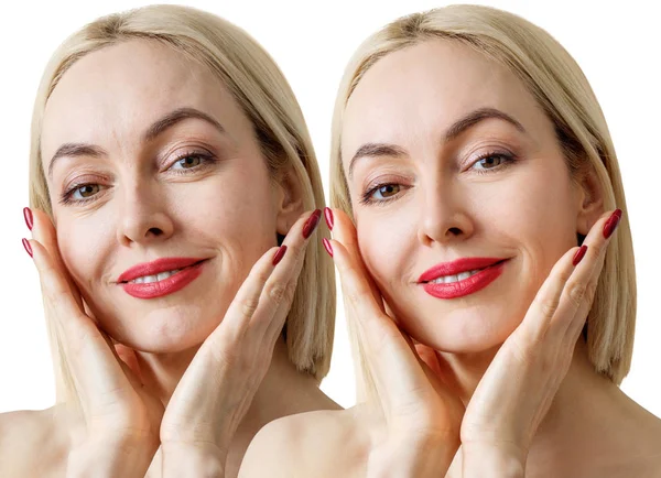 Ενηλίκων αισθησιακή γυναίκα πριν και μετά το δέρμα ρετούς ή θεραπεία. — Φωτογραφία Αρχείου