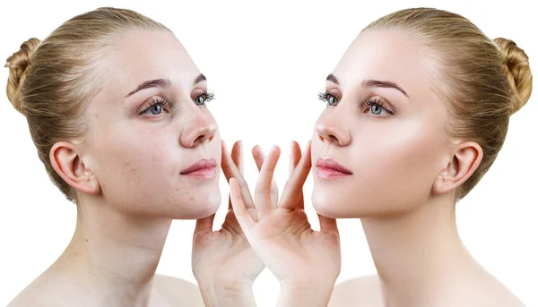 Retrato comparativo de una mujer joven antes y después del retoque . — Foto de Stock