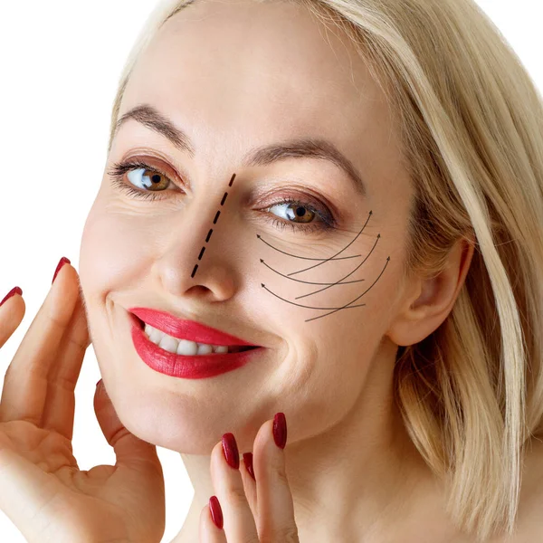 Grafikus vonalak azt mutatják, arcfelvarrás hatása a bőr gyönyörű nő. — Stock Fotó