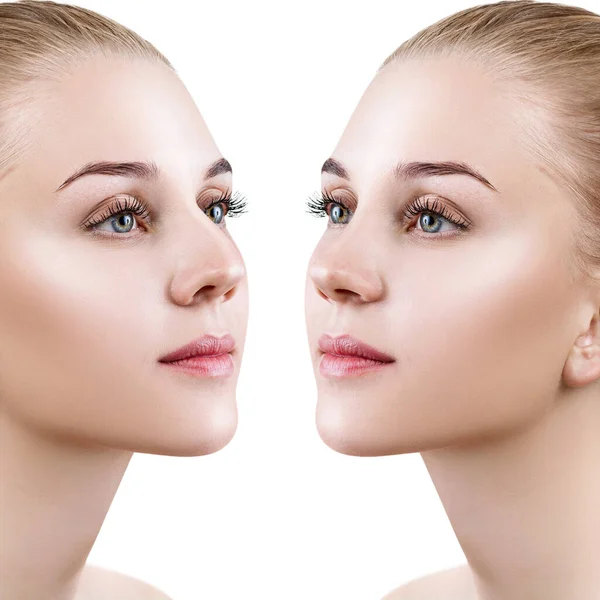 Vrouwelijke neus voor en na cosmetische chirurgie. — Stockfoto