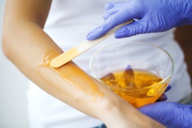 Master şeker yapıştırın sıcak balmumu yardımıyla el epilasyon yapar 