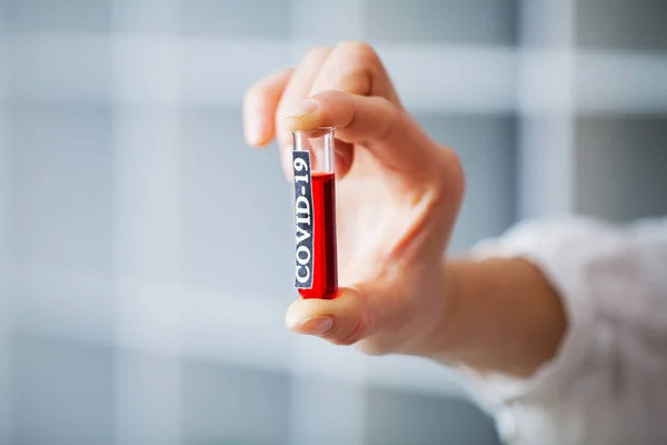 Stock image Doctor holds test tube with covid-19 test