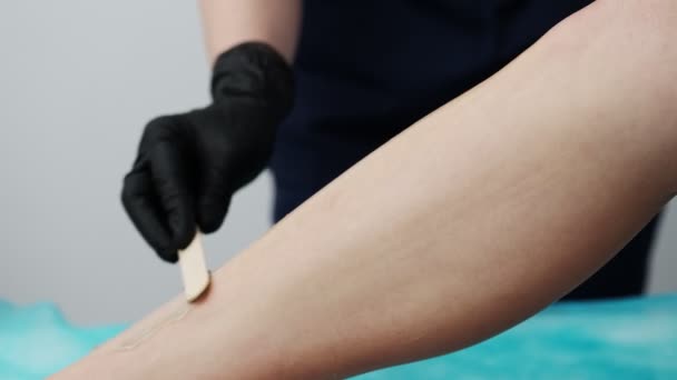 Jonge vrouw ontvangt laser ontharing voor benen bij schoonheidssalon — Stockvideo