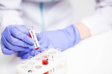 Hastanedeki kadın koronavirüs için kan testi yaptırıyor.