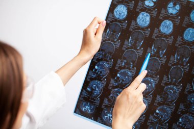 Doktor hastaların kafalarının MR görüntülerini inceliyor.