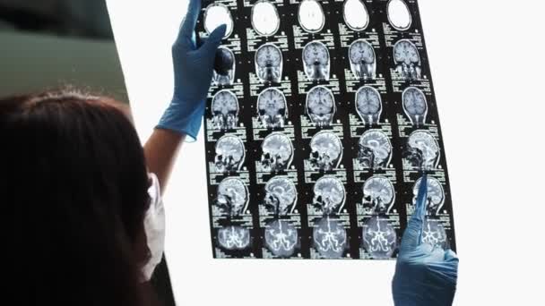Il medico esamina un'immagine MRI del cervello dei pazienti . — Video Stock