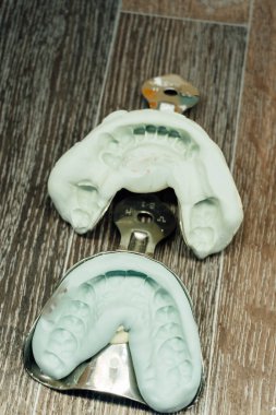 bireysel alçı çene örneği, yakın plan, diş hekimliği ve süreç ayrıntıları kavramı  