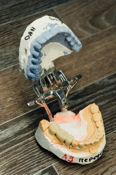 Bireysel Alçı Çene Örneği Yakın Plan Diş Hekimliği Süreç Ayrıntıları — Stok fotoğraf