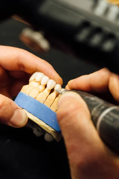 hands of dental technician making sample individual plaster jaw, close-up,  Dental dentistry and process details concept