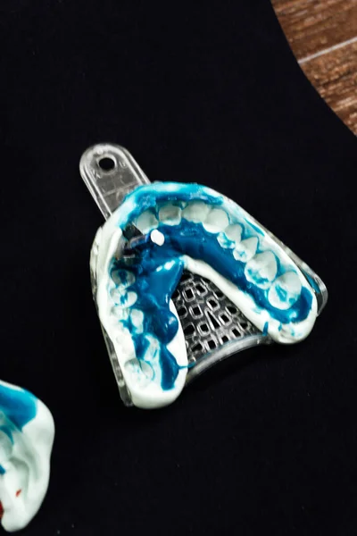 個々の石膏の顎のサンプル クローズアップ 歯科歯科とプロセスの詳細概念 — ストック写真
