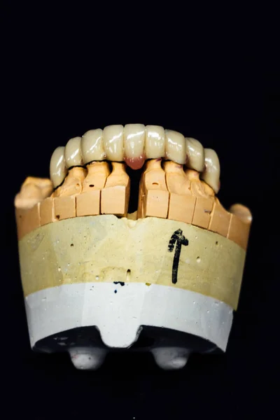 Sample Individual Plaster Jaw Close Dental Dentistry Process Details Concept — Stock Photo, Image