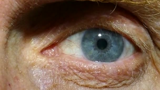 An eye of  old man with red capillaries. Macro