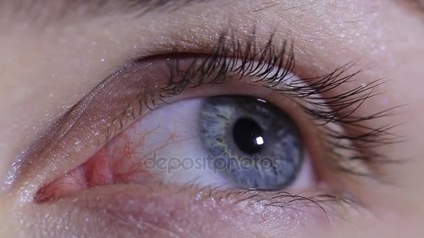 Natural Female Eye Pupil Red Capillaries Macro — Stock Video