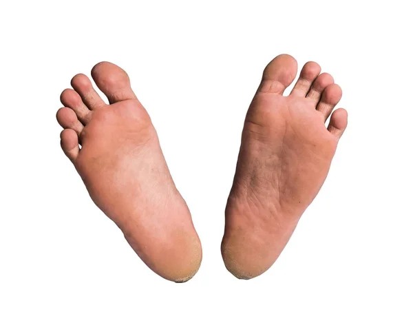 Foot on white background — Stock Photo, Image