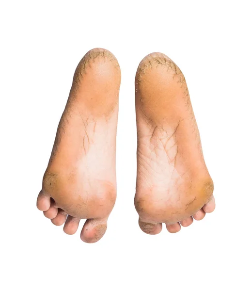 Foot on white background — Stock Photo, Image