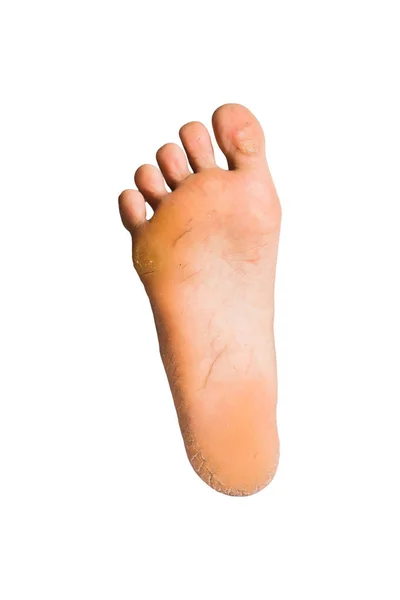 Foot on white background — Stock Photo, Image