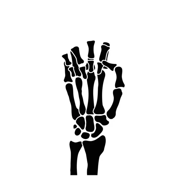 白色背景上的手骨 — 图库矢量图片
