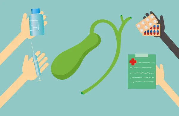 insan safra kesesi tedavisinde. vektör