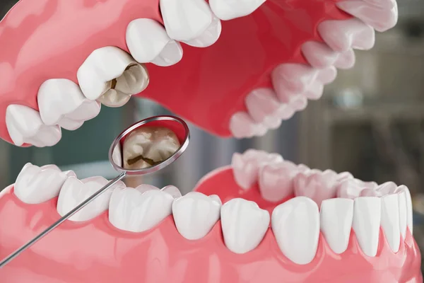 Close Cuidado Salud Los Dientes Belleza Sobre Fondo Blanco Enfoque — Foto de Stock