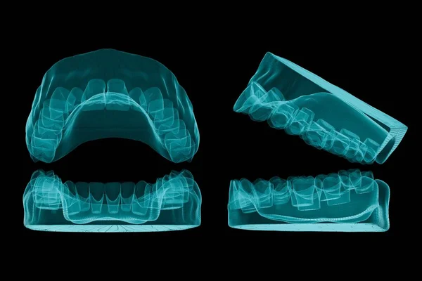 Cuidado Salud Los Dientes Rayos Sobre Fondo Negro Renderizado — Foto de Stock