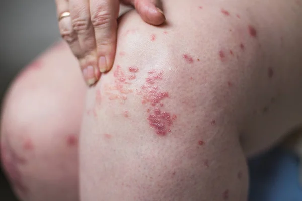 Salbe zur Hand. Anwendung der Salbe bei der Behandlung und Hydratation der Haut. horizontales Foto. leere Kopie Spase auf Creme Tube — Stockfoto