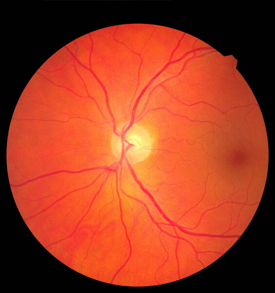 Ophthalmic image detailing the retina and optic nerve inside a healthy human eye. Medicine concept