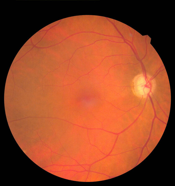 Внутри человеческого глаза видны сетчатка, зрительный нерв и макула. Концепция здоровья