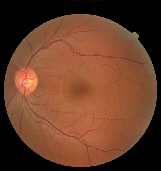 Vista dentro del ojo humano mostrando retina, nervio óptico y macula. Concepto sanitario — Foto de Stock