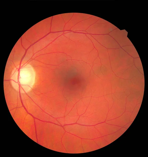 İnsan gözü anatomisi Mydriatic Retinal kameralarla görüntü alıyor. Göz muayenesi, diyabetik retinopati, ARMD