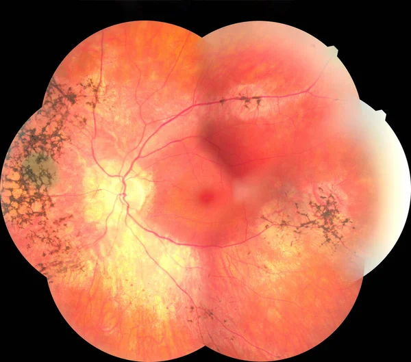 Imagen oftálmica que detalla la retina y el nervio óptico dentro de un ojo humano sano. Concepto de protección sanitaria — Foto de Stock